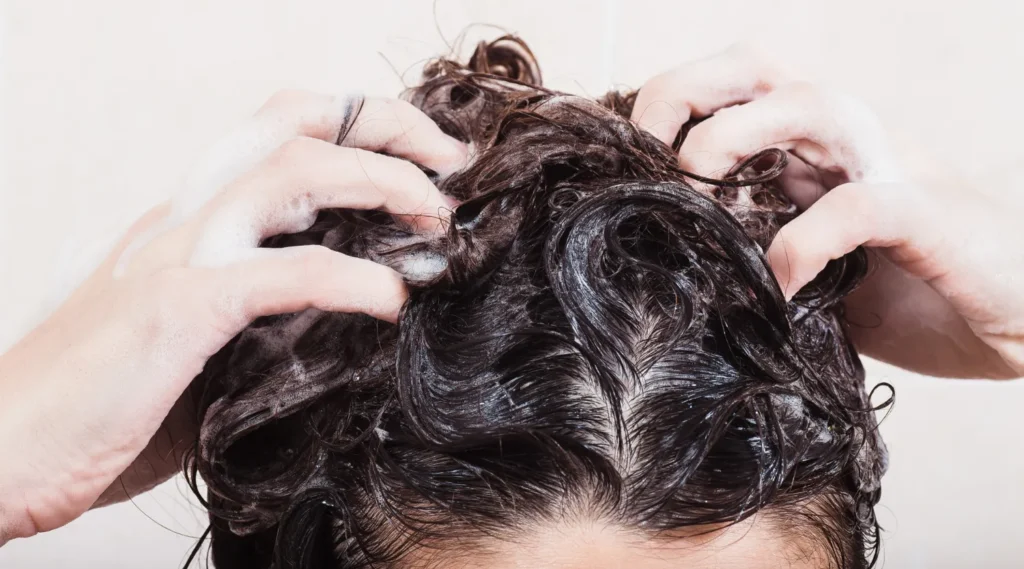 Common Causes of Dandruff